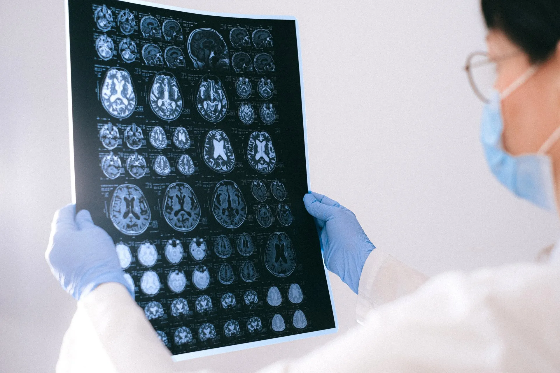 Traumatic Brain Injury